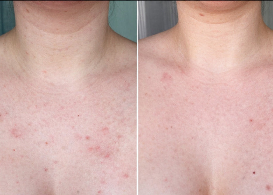 Contoura™ Cleanse Stick